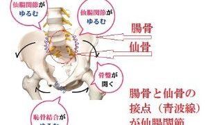 腰痛のタイプ
